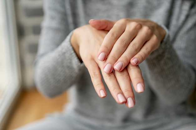 Расслоение и утолщение ногтей: признаки псориаза